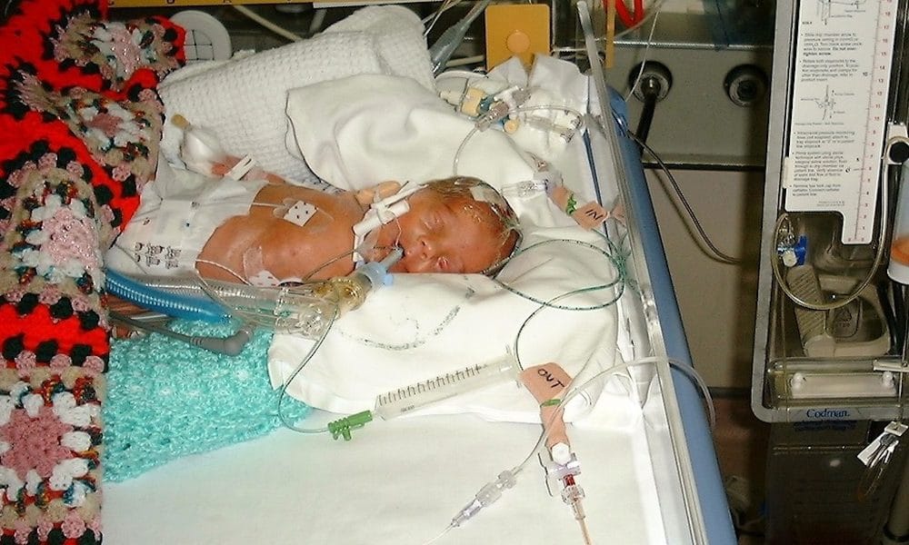 The baby who helped to create pioneering ‘brain-washing’ treatment
