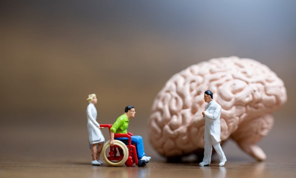 Miniature people, Surgeon spoke with patient about brain injuries. A conversation on brain injury
