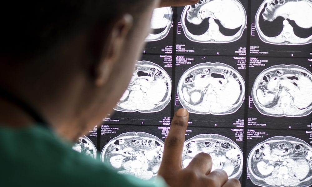 New understanding of consciousness after brain injury