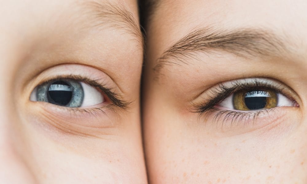 Visual impairment ‘may affect 1 in 30 children’