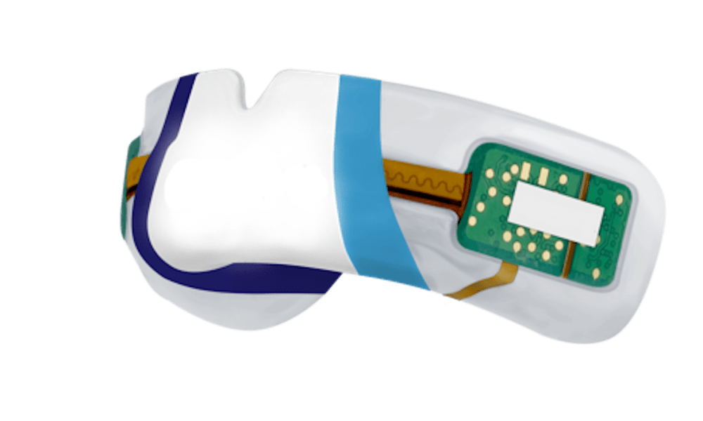 Is this mouthguard set to revolutionise player safety?
