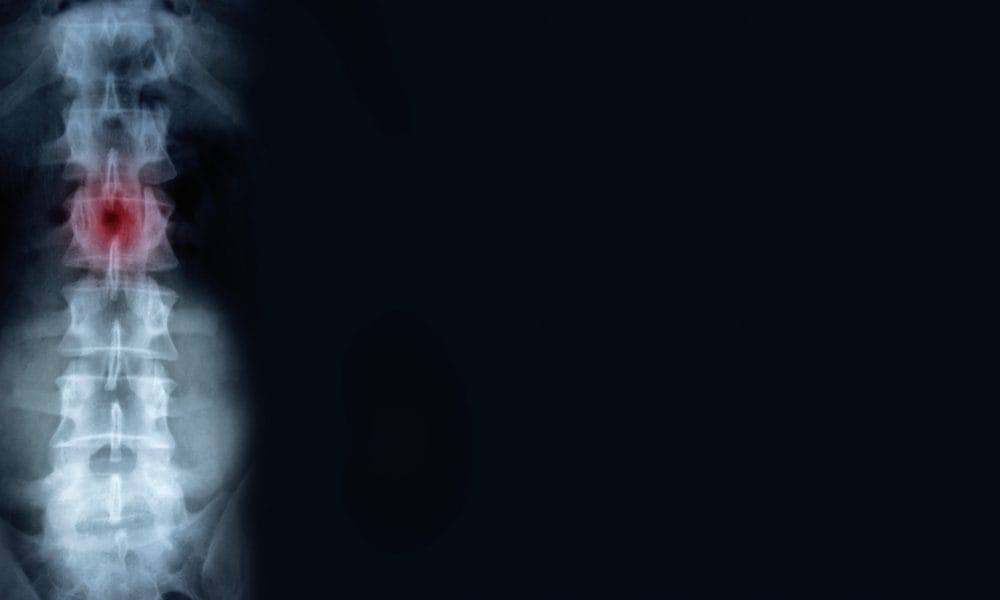 Fresh hope for spinal injury outlook through new research