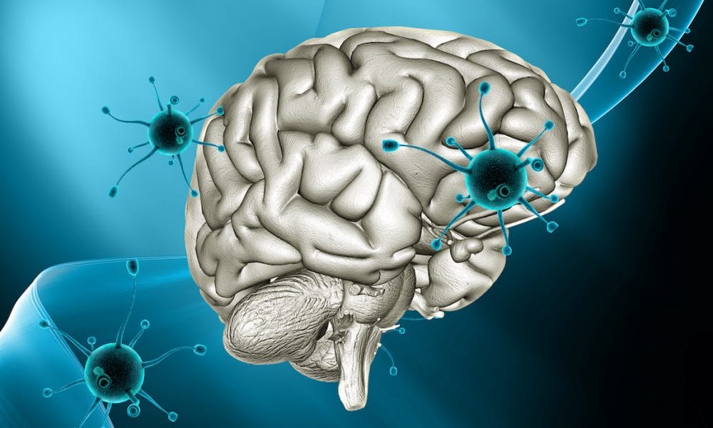 3D medical background with virus cells attacking a brain Research highlights how COVID-19 enters the brain