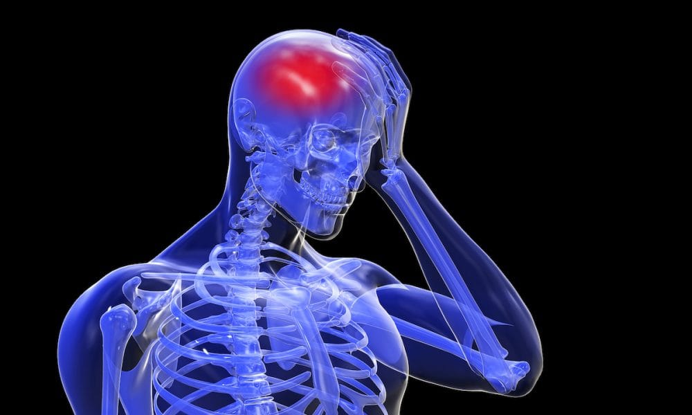 What happens to brain when a stroke occurs?