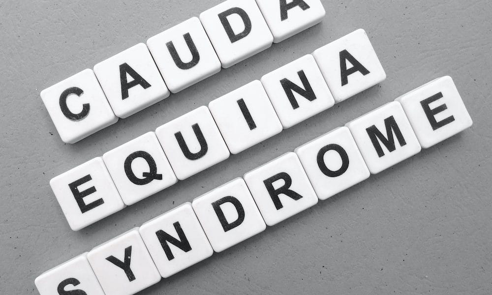 CES – shedding light on a misunderstood condition