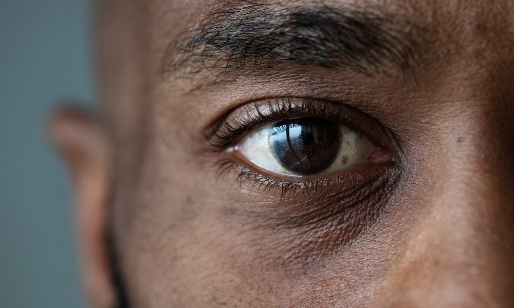 Closeup of an eye of a black man New study discovers potential cure for dementia and depression