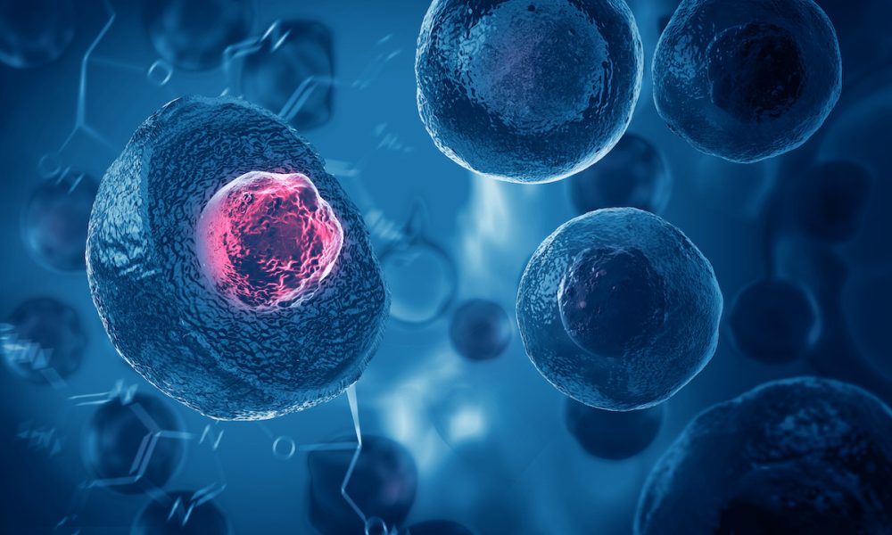 Novel Parkinson’s treatment shows promise in clinical trial