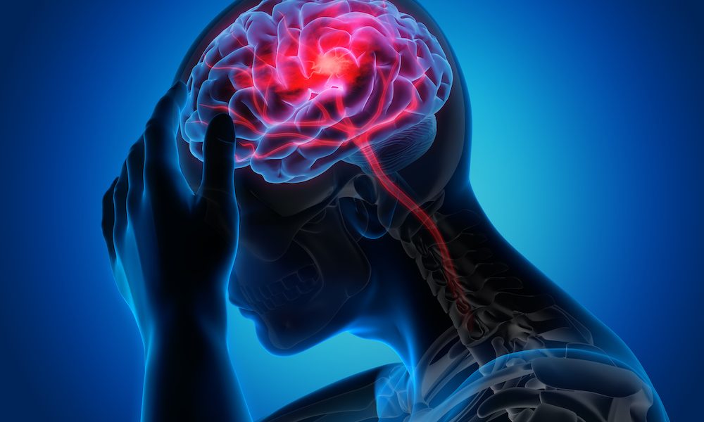 Stroke Optical tech breakthrough could boost stroke interventions