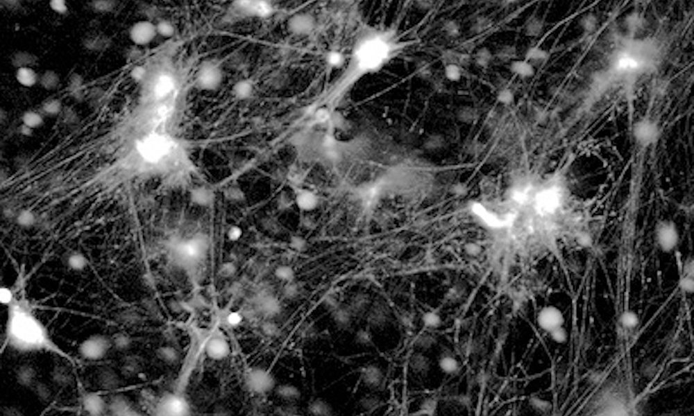 Five stroke technologies to look out for in 2022