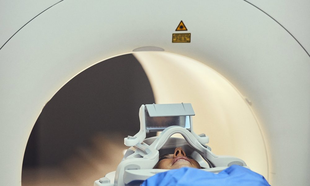 How AI can help save time and lives after stroke
