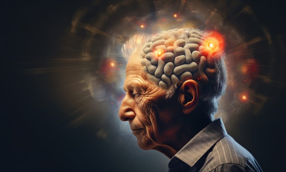 Would you take the dementia test as part of your financial planning journey?