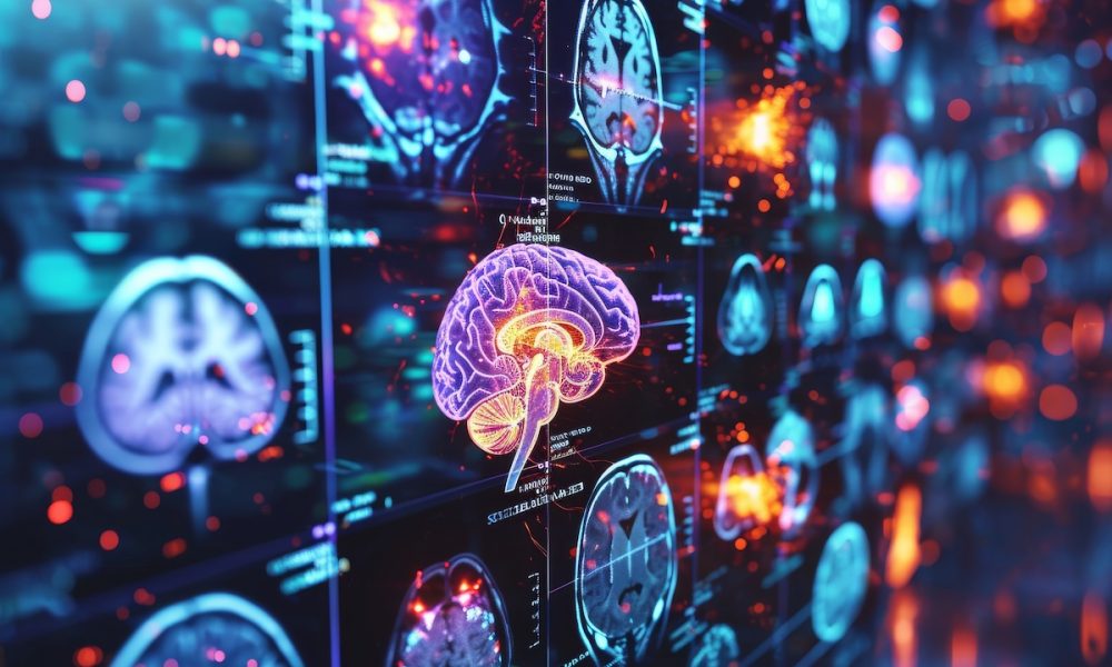 Understanding The Cognitive Impact Of Different Neurological Conditions. Сoncept Autism Spectrum Disorders, Alzheimer’s Disease, Traumatic Brain Injury, Parkinson’s Disease, Schizophrenia Monitoring the brain post-injury with optical fibres