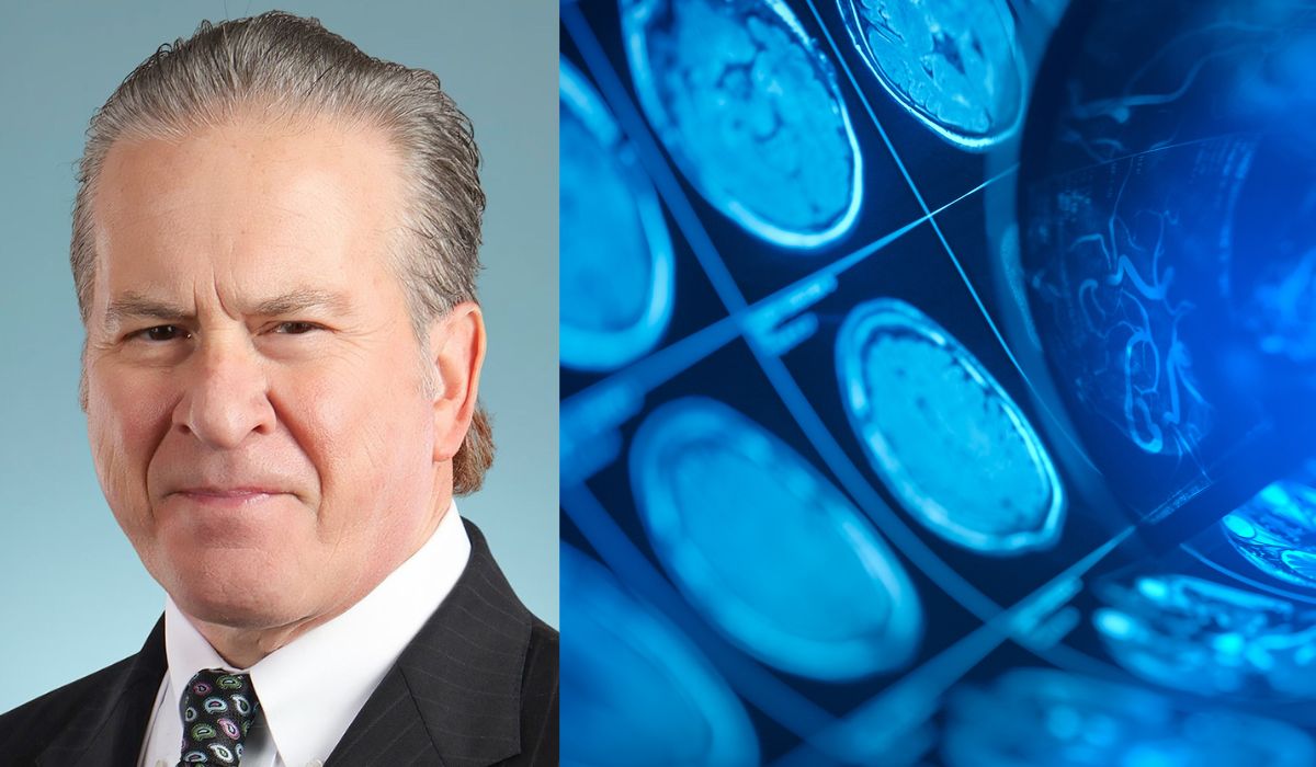 Untitled design-5 World first could see CTE diagnosis in live patients