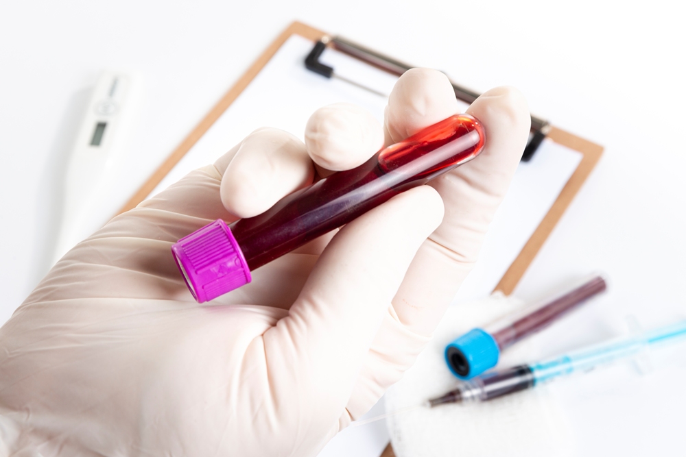 Test could predict Alzheimer’s from a blood sample