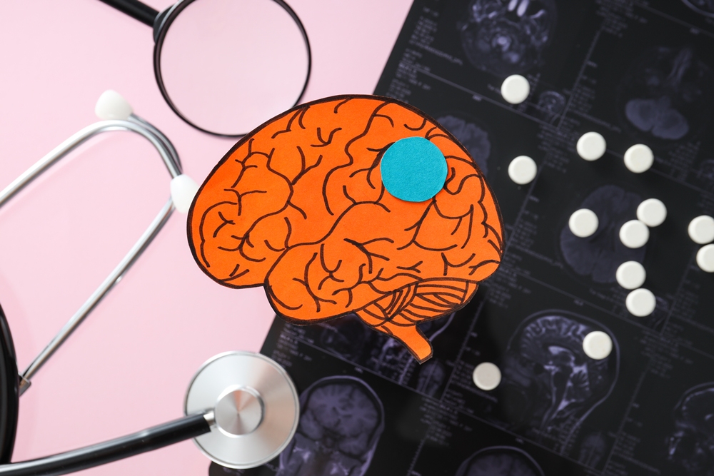 Brain training may improve TBI outcomes