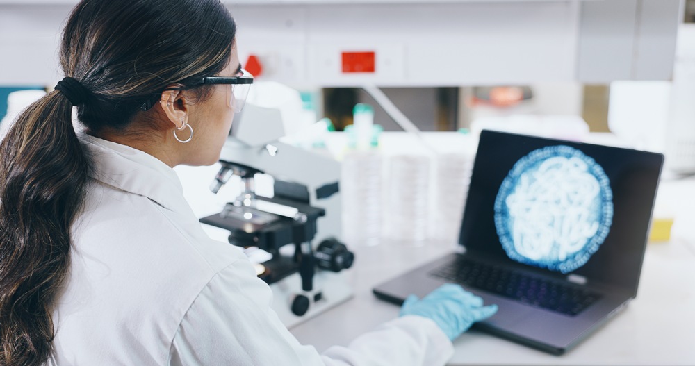 Cellular Intelligence acquires rights to Novo Nordisk Parkinson’s cell therapy