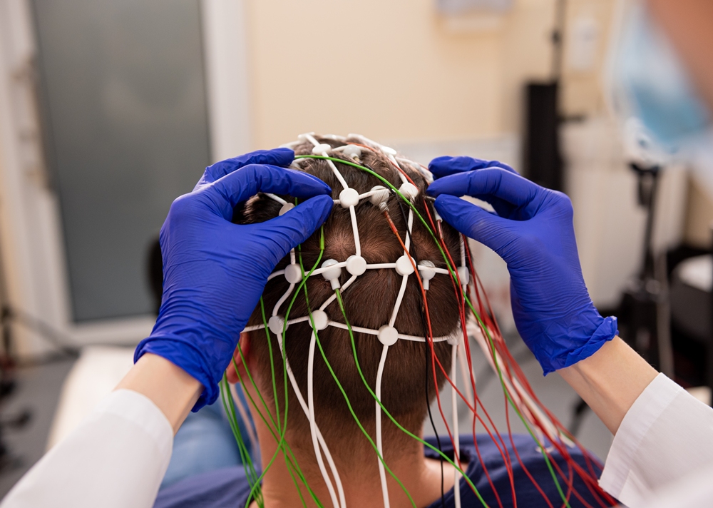 Brain-computer interface training could improve cognitive function in TBI patients, study suggests