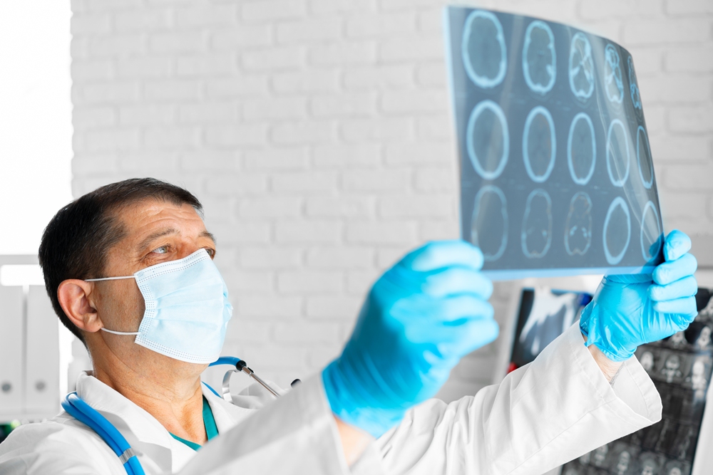 First-ever stem-cell brain transplant for Parkinson’s passes major safety test