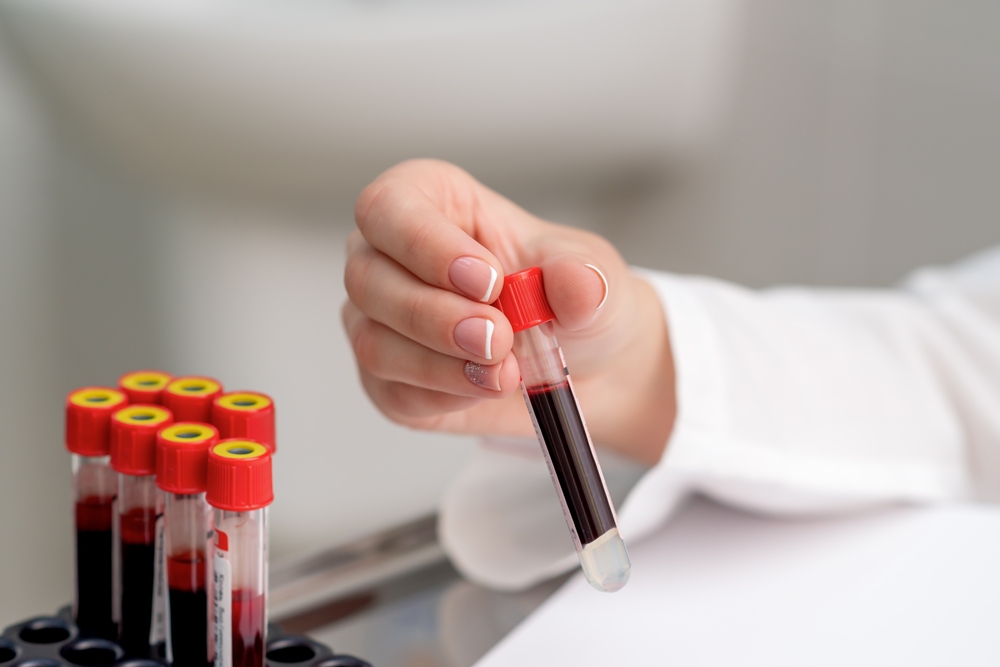 New 15-minute blood test checks for brain injuries