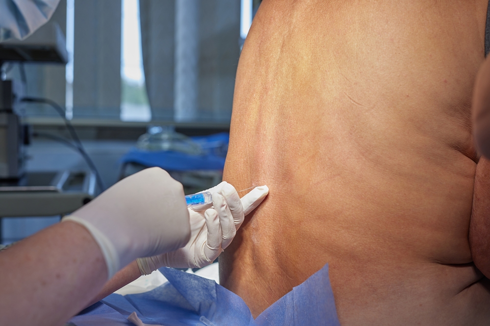 Saline used as placebo in clinical trails may have spinal injury benefits – study