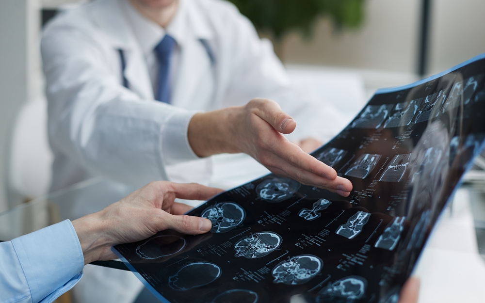 Young man looking at one of x-ray results being shown by his doctor Younger brains’ post-injury recovery comes at a cost, study suggests